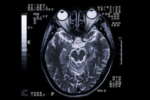 【最新技術と丁寧な対応】千葉市で根管治療を受けるなら選びたい信頼の歯科医院ガイド