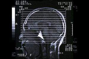 四条にある人気の矯正歯科クリニック