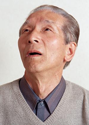 手術なしで視力矯正ができる技術があります