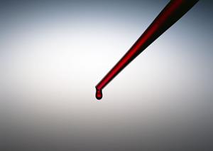 富士宮でインプラントを検討しているなら